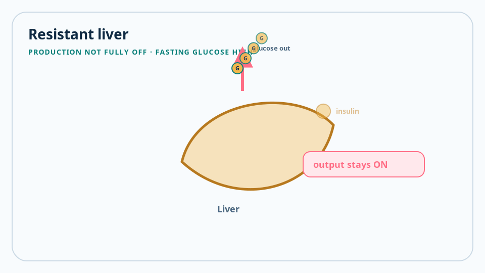 Animated liver schematic showing glucose output that stays on when insulin resistance is present